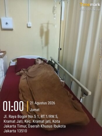 Nasib TKW asal Brebes Mengalami kecelakaan Kerja di Singapura,Tidak di perdulikan oleh P3MI saat ini terkapar di RS Polri Kramat jati